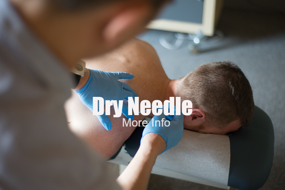 Dry Needling